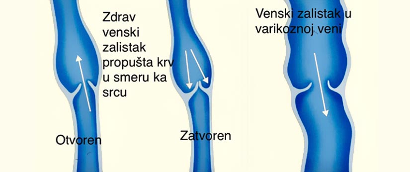 Bolesti vena Kolegium Medic Beograd