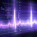 Lupanje srca - palpitacije