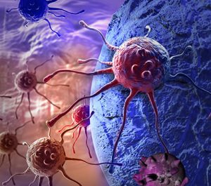 Karcinom želuca - Gastroenterologija - Kolegium Medic