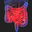 Inflamatorne bolesti creva - Kolegium Medic