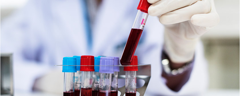 Hematologija - Kolegium Medic Hematologija - Kolegium Medic