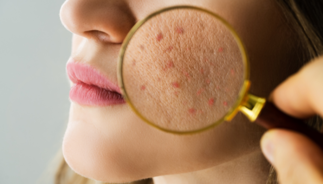Dermatologija